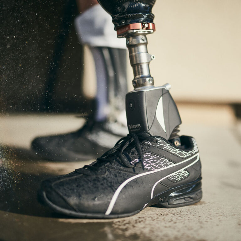 Lower Limb Bionic Prosthetics | Vesalius