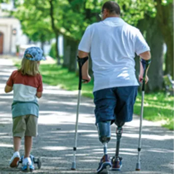 Αντιμετώπιση της Απώλειας Άκρων: Συμβουλές & Στρατηγικές